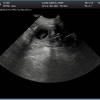 Lila.Ladd-ultrasound