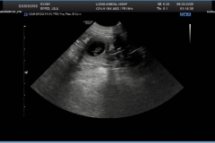 Lila.Ladd-ultrasound