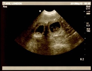london-ultrasound